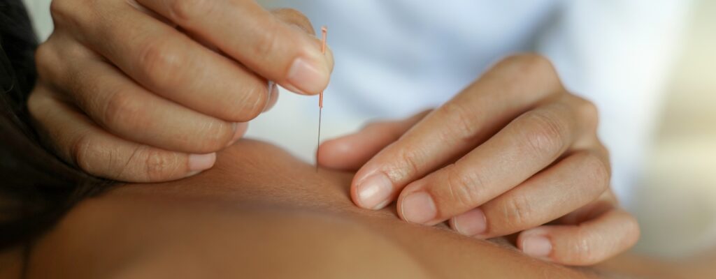 Is Dry Needling Effective for Treating Low Back Pain?