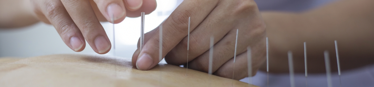 Dry Needling Grand Junction, CO- Western Slope Rehab and Performance