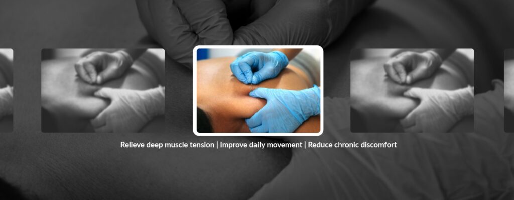 Breaking the Cycle: How Dry Needling Helps Chronic Pain
